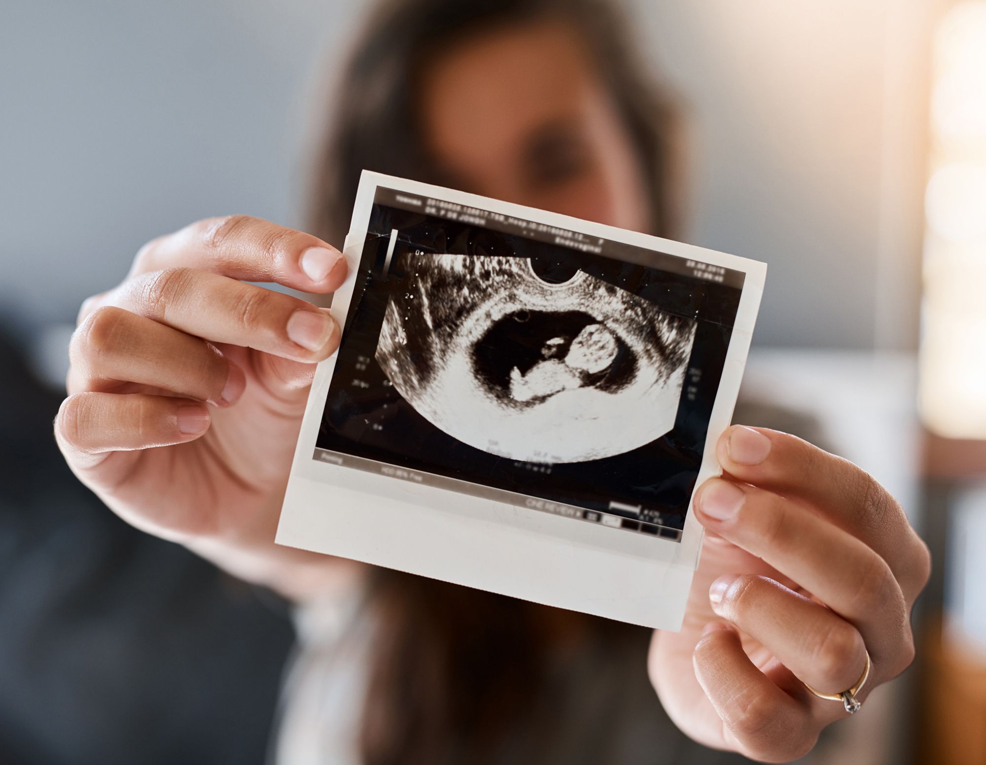 Schwangere Frau hält ein Ultraschallbild in die Kamera